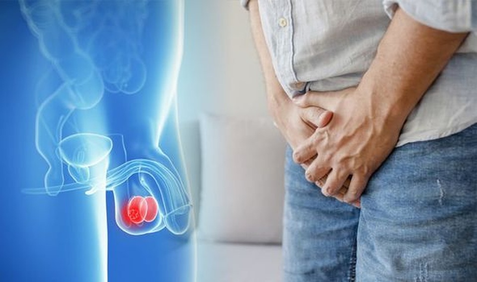 7 bệnh ung thư có tỷ lệ sống sót sau 5 năm cao nhất - 2 7 bệnh ung thư có tỷ lệ sống sót sau 5 năm cao nhất - 2