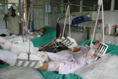 Hơn 92 triệu đồng đến với các nạn nhân đang nằm điều trị tại Viện bỏng Quốc gia