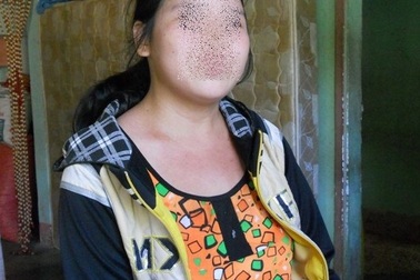 Nghi án thiếu nữ thiểu năng trí tuệ bị xâm hại