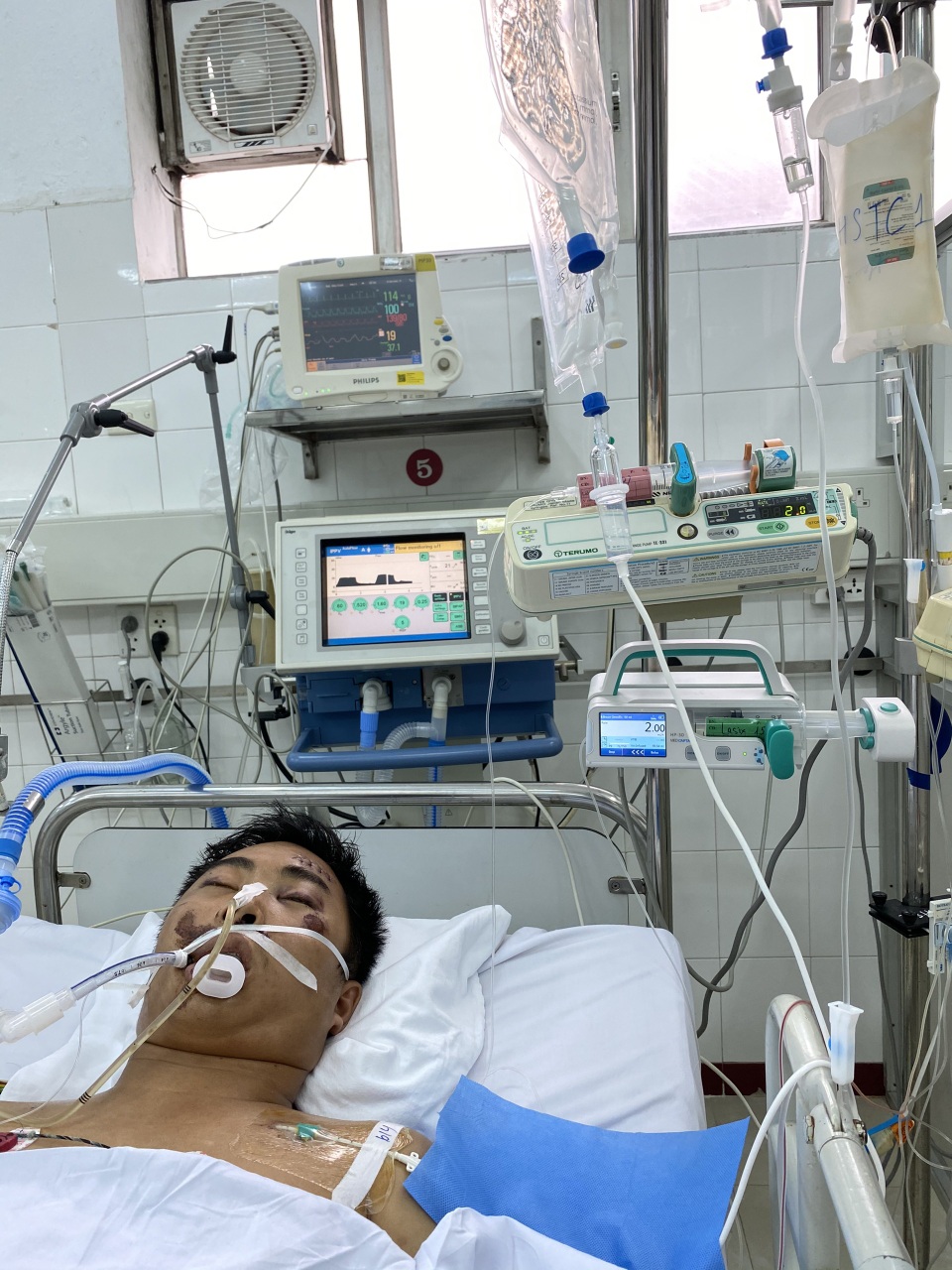Hoàn cảnh chàng trai hăng hái chống giặc Covid - 19 gặp nạn nguy kịch - 3 Hoàn cảnh chàng trai hăng hái chống giặc Covid - 19 gặp nạn nguy kịch - 3