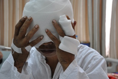 Bị gấu tấn công, người đàn ông dân tộc Mông mất cả 2 mắt