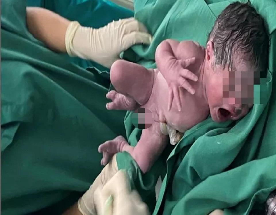 Ung thư vòm họng thai kỳ thách thức lớn trong điều trị - 1 Ung thư vòm họng thai kỳ thách thức lớn trong điều trị - 1