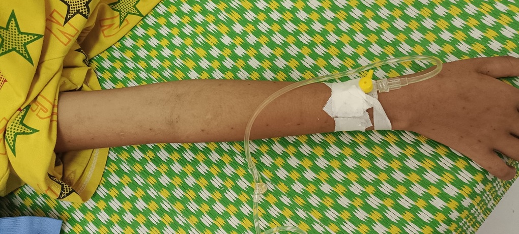 Trẻ nhập viện với chi chít vết rạch bằng dao lam trên cánh tay - 1 Trẻ nhập viện với chi chít vết rạch bằng dao lam trên cánh tay - 1
