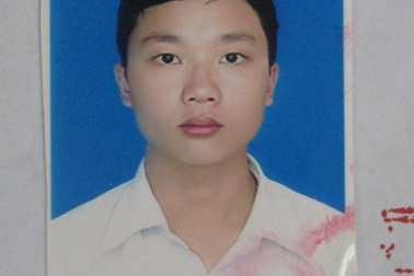 Bố trí phòng thi riêng cho thí sinh bị chấn thương cánh tay phải