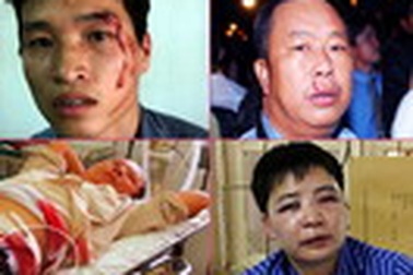 Nhức nhối tình trạng hành hung, cản trở nhà báo tác nghiệp