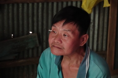 Gia cảnh khốn cùng: Con bị tai nạn nứt sọ, bố tâm thần bất ổn mong cứu giúp