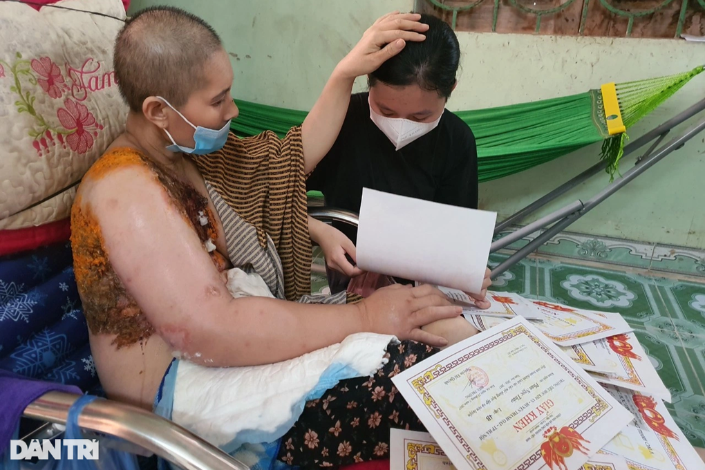 Người mẹ ung thư nghẹn ngào em không còn nước mắt để khóc - 6 Người mẹ ung thư nghẹn ngào em không còn nước mắt để khóc - 6