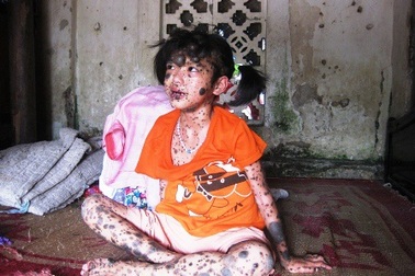 Gặp lại bé gái mơ một ngày được làm thiếu nữ