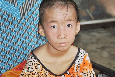 Thương bé gái bị lở loét khắp người phải nghỉ học vì không tiền chữa bệnh