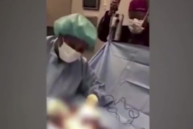 Khó hiểu bác sỹ tự quay clip nhảy hip hop điên cuồng khi đang phẫu thuật cho bệnh nhân