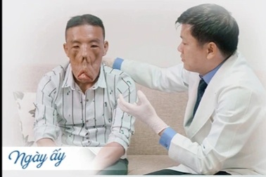 Tiến sĩ vá dị dạng "lì lợm" và những lần đi xin việc bị... đuổi thẳng