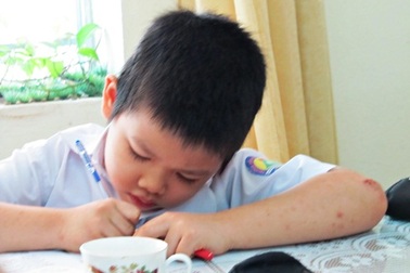 Không xét vượt cấp cho cậu bé lớp 1 giải được toán lớp 3 