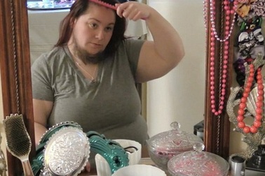 Mắc bệnh lạ, một phụ nữ mọc râu quai nón như đàn ông