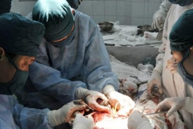 Chuyện chị em: Phiền toái với ngực “khủng”