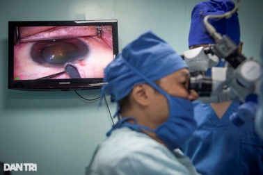 Hồi hộp xem bác sĩ thay thủy tinh thể qua vết mổ 2,2mm trên mắt