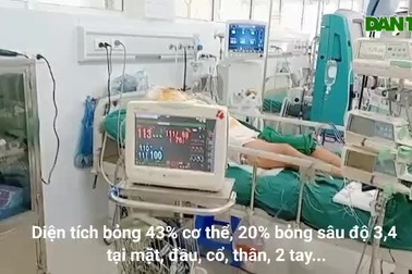 Người đàn ông nghèo nguy kịch vì bỏng lửa xăng 43% cơ thể