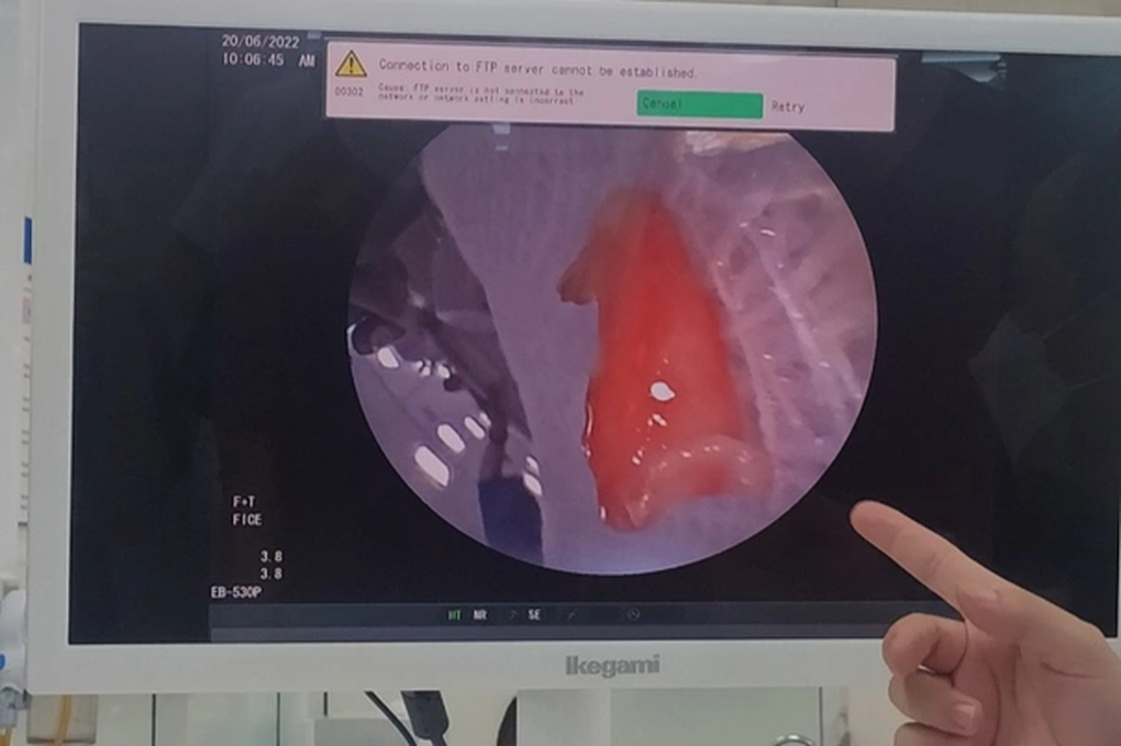 Bé trai đột ngột quấy khóc rồi phải thở máy: Bất ngờ với thủ phạm - 2 Bé trai đột ngột quấy khóc rồi phải thở máy: Bất ngờ với thủ phạm - 2