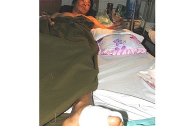 Tái tạo ngón tay cái từ ngón chân