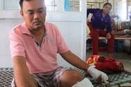 Phá giá chở khách, chủ xe bị đánh trọng thương?