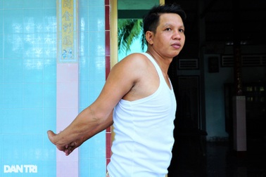 Người đàn ông có hai cánh tay "cao su" bẻ gập được 180 độ ra sau lưng