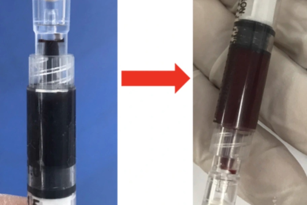 TPHCM: 5 người ngộ độc hóa chất nặng, bệnh viện khẩn cấp chia sẻ thuốc hiếm - 2 TPHCM: 5 người ngộ độc hóa chất nặng, bệnh viện khẩn cấp chia sẻ thuốc hiếm - 2