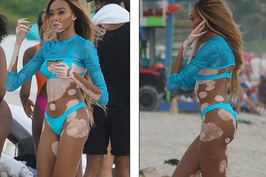 "Chân dài" bạch biến Winnie Harlow sải bước quyến rũ trên biển