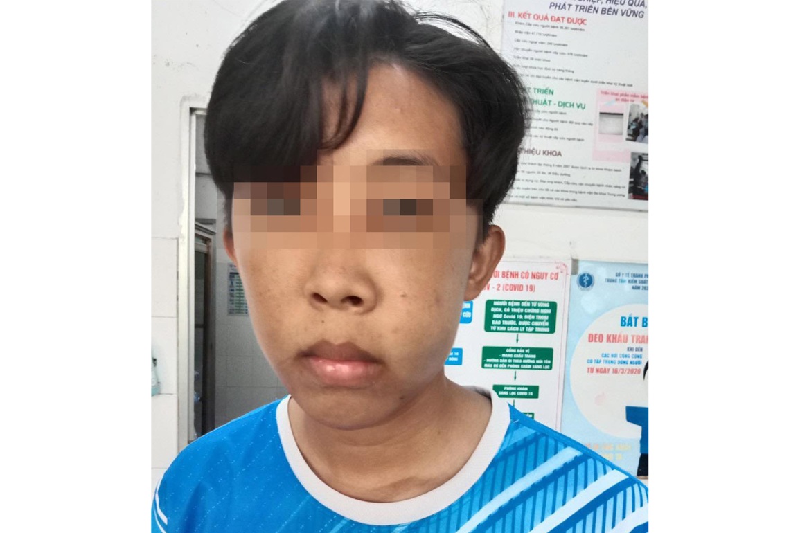 Nam sinh lớp 9 bị bảo vệ của trường đánh gãy xương hàm - 1 Nam sinh lớp 9 bị bảo vệ của trường đánh gãy xương hàm - 1