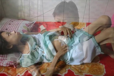 Hoàn cảnh đáng thương của bé Vy