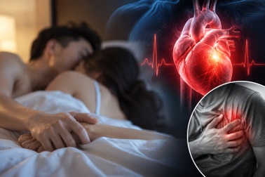 Ngừng tim khi "yêu" cực hiếm, 94% trường hợp trong nghiên cứu là nam giới