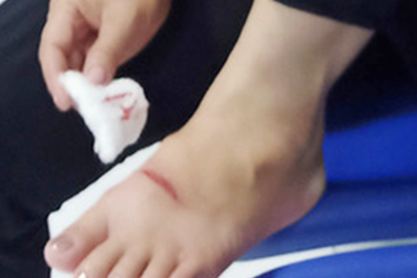 Vụ chó dữ cắn nhiều người: Chó bị bệnh dại