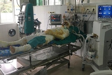 Lấy nước mắm, mỡ trăn chữa bỏng, ruồi nhặng theo bệnh nhân vào tận viện