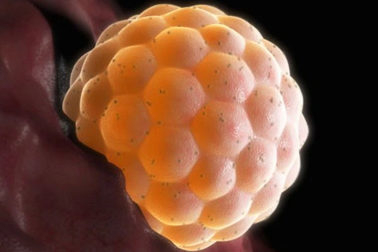 Những bệnh ung thư nguy hiểm chỉ gặp ở phụ nữ