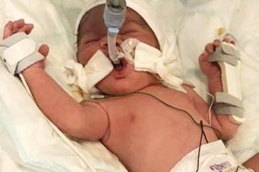 Thai phụ bị nỏ bắn xuyên bụng tử vong, thai nhi vẫn sống sót thần kỳ