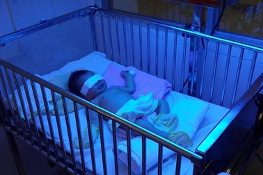 Bé gái 2 ngày tuổi bị mẹ cắn cụt đốt ngón tay