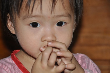 Ca mổ cấy điện cực ốc tai cho bé Như Quỳnh đã thành công