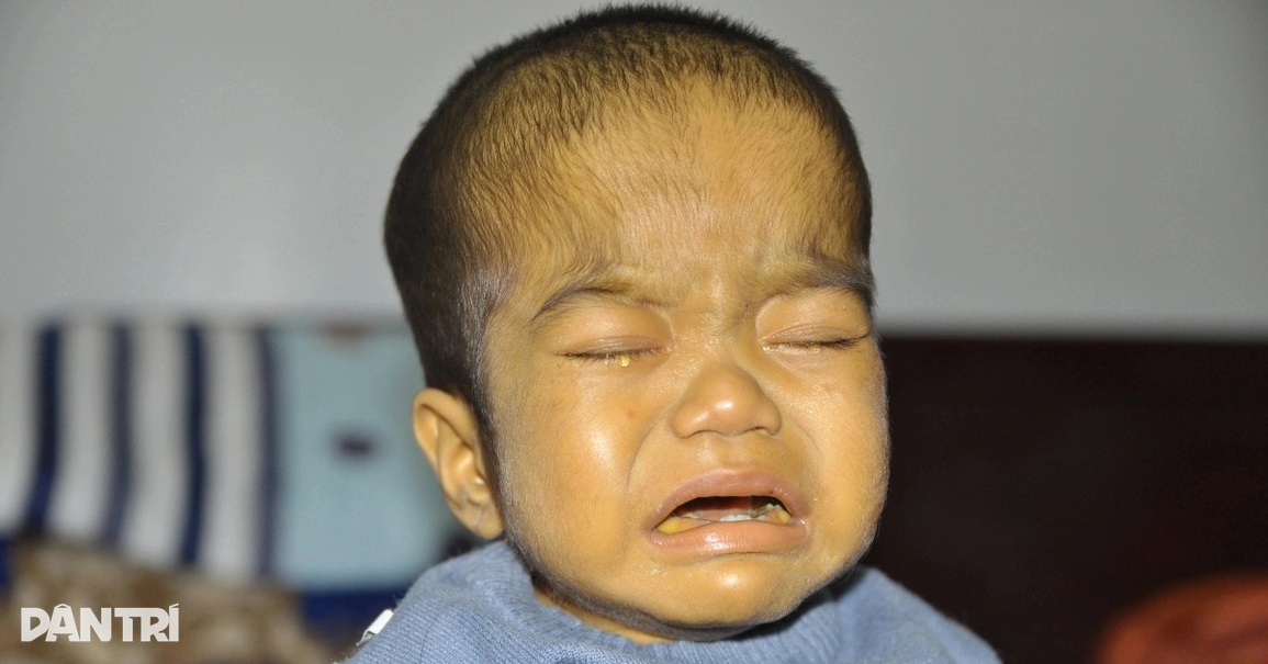Cậu bé vàng như củ nghệ Duy Anh đã mãi mãi ra đi - 1 Cậu bé vàng như củ nghệ Duy Anh đã mãi mãi ra đi - 1