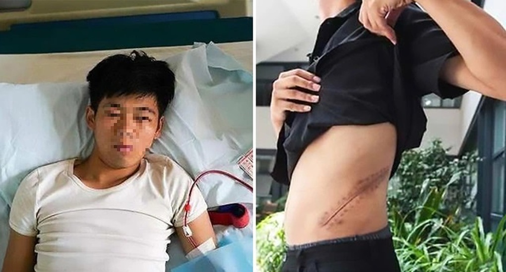 Vương Thượng Côn phải nằm liệt giường vì vết mổ sau khi anh bán thận của mình (phải) bị nhiễm trùng (Ảnh: Sohu). Vương Thượng Côn phải nằm liệt giường vì vết mổ sau khi anh bán thận của mình (phải) bị nhiễm trùng (Ảnh: Sohu).