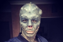 Đang là trai đẹp vẫn quyết phẫu thuật thành "người ngoài hành tinh"