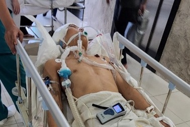 Va quẹt xe dừng đèn đỏ, một người bị đánh chấn thương sọ não