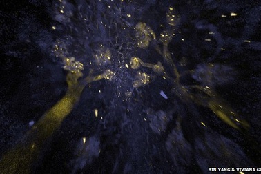 Thiết bị nhìn thấu nội tạng cơ thể người