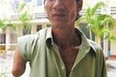 Bệnh nhân đau dạ dày bị cắt tay: 13 năm chờ bồi thường