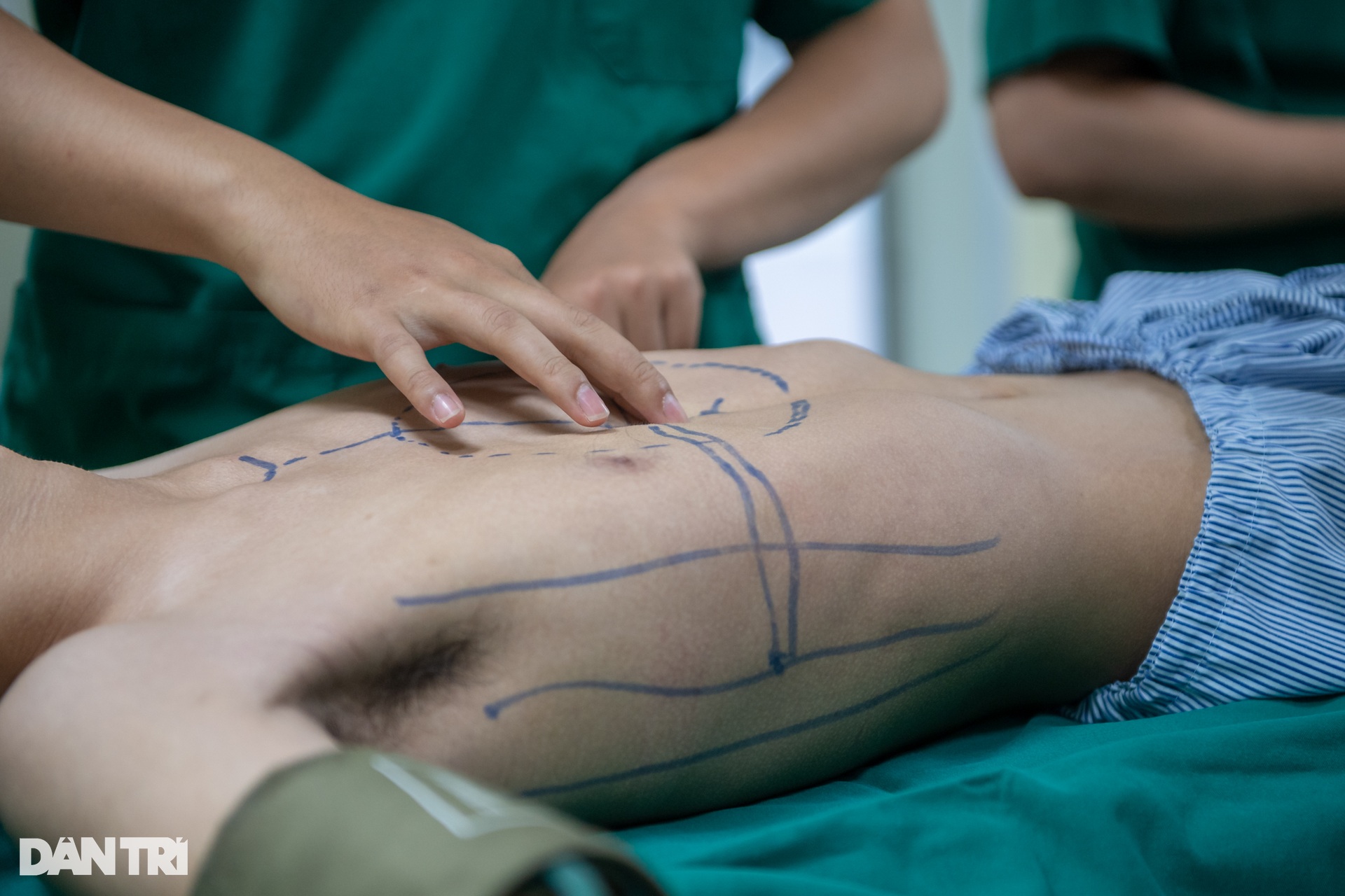 Xem bác sĩ dùng thanh titan uốn xương cho chàng trai lõm ngực - 2 Xem bác sĩ dùng thanh titan uốn xương cho chàng trai lõm ngực - 2