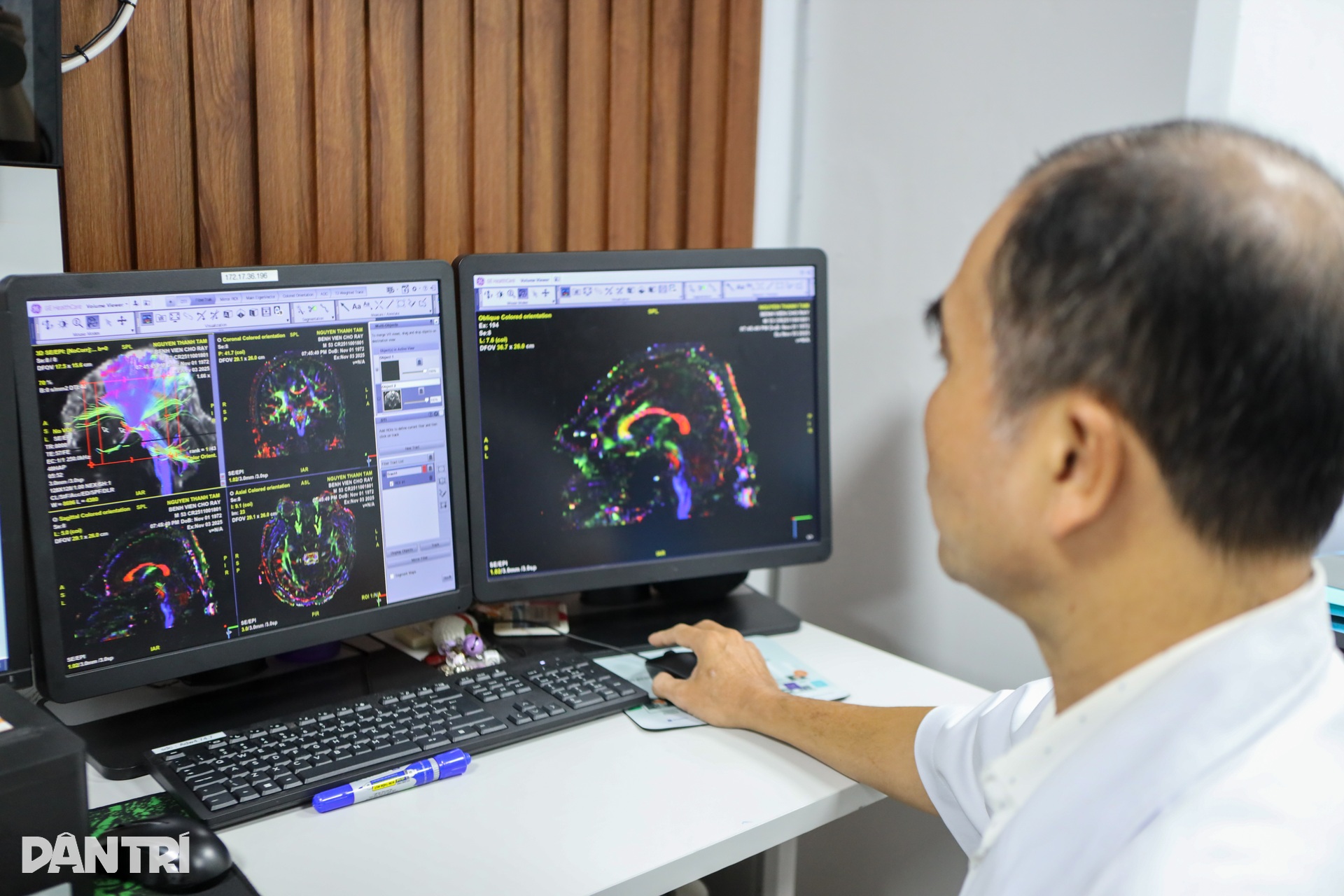 Chợ Rẫy vận hành máy MRI hiện đại nhất phía Nam, chụp nhanh gấp đôi - 6