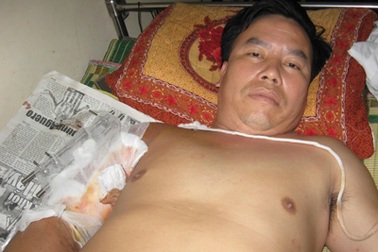 Thiếu tá biên phòng bị găm hàng chục viên đạn vào cánh tay