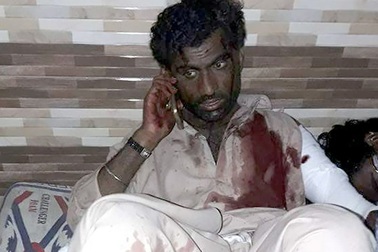 IS đánh bom đẫm máu tại Pakistan, 72 người chết