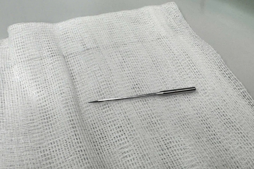 Gắp kim may 4cm trong bụng bé 11 tuổi - 1 Gắp kim may 4cm trong bụng bé 11 tuổi - 1