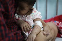 Những em bé đeo ống thở, mệt nhoài trong viện vì không tiêm vaccine sởi