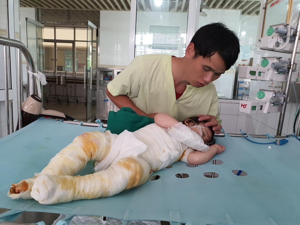 Đau nhói lòng cảnh bé gái 14 tháng tuổi ngã vào nồi nước sôi nguy kịch - 6 Đau nhói lòng cảnh bé gái 14 tháng tuổi ngã vào nồi nước sôi nguy kịch - 6