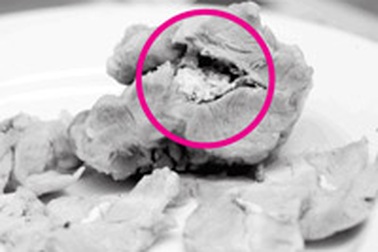 Thịt lợn hại người