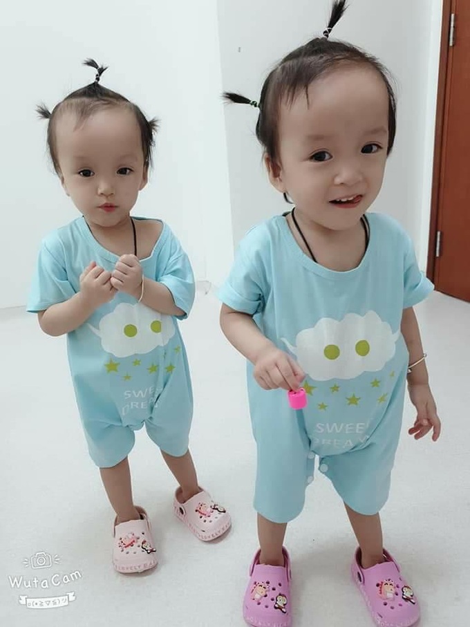 Cặp song sinh Trúc Nhi - Diệu Nhi: Diệu Nhi phẫu thuật để hoàn chỉnh đường tiêu hóa - Ảnh 2. Cặp song sinh Trúc Nhi - Diệu Nhi: Diệu Nhi phẫu thuật để hoàn chỉnh đường tiêu hóa - Ảnh 2.
